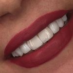 مركز ايمپلنت و زيبايى دکتر آنيتا کاظمى