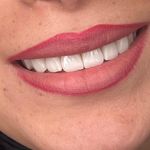 مركز ايمپلنت و زيبايى دکتر آنيتا کاظمى