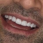 مركز ايمپلنت و زيبايى دکتر آنيتا کاظمى