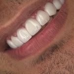 مركز ايمپلنت و زيبايى دکتر آنيتا کاظمى