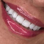 مركز ايمپلنت و زيبايى دکتر آنيتا کاظمى