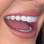 مركز ايمپلنت و زيبايى دکتر آنيتا کاظمى