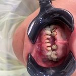 مركز ايمپلنت و زيبايى دکتر آنيتا کاظمى