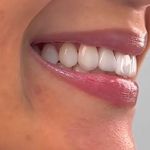 مركز ايمپلنت و زيبايى دکتر آنيتا کاظمى