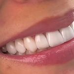 مركز ايمپلنت و زيبايى دکتر آنيتا کاظمى