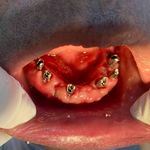 مركز ايمپلنت و زيبايى دکتر آنيتا کاظمى