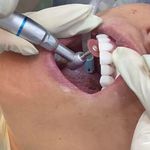 مركز ايمپلنت و زيبايى دکتر آنيتا کاظمى