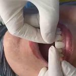 مركز ايمپلنت و زيبايى دکتر آنيتا کاظمى