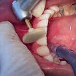 مركز ايمپلنت و زيبايى دکتر آنيتا کاظمى