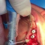 مركز ايمپلنت و زيبايى دکتر آنيتا کاظمى