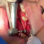 مركز ايمپلنت و زيبايى دکتر آنيتا کاظمى