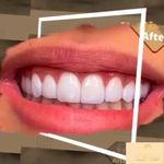 مركز ايمپلنت و زيبايى دکتر آنيتا کاظمى