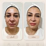 مرکز لیرز و جوانسازی پوست شهربانو