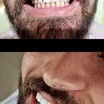 کلینیک دندان پزشکی و ایمپلنت الیسو