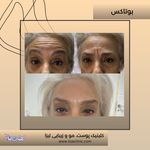 مطب پوست مو زیبایی فردوس شرق