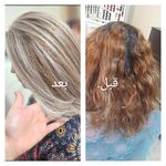 اپیلاسیون مارینو تخصصی