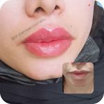 کلینیک زیبایی، پوست ،مو و لیزر مهرینا