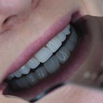 کلینیک دندانپزشکی دکتر گلنوش قاسم زاده