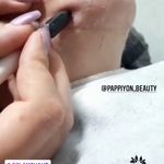 کلینیک پوست و مو و لیزر پاپیون