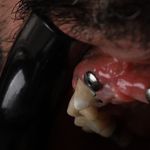 دکتر کیارش مهدی پور جراحی لثه و ایمپلنت