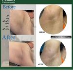 پاکسازی و فیشال صورت نازین