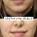 کلینیک پوست،مو،زیبایی،مرکز لیزر ‌پرنسا