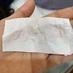 فیشال و پاکسازی تخصصی پوست تحت نظر پزشک