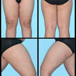 فتوگرافی پزشکی مظلومی