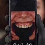 کلینیک تخصصی تهران ایمپلنت