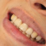 مطب دندانپزشکی دکتر فاطمه محمودی افصح