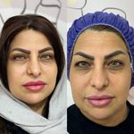 کلینیک تخصصی زیبایی و لیزر ویان
