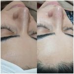 کلینیک تخصصی پاکسازی و فیشیال پوست زارعی