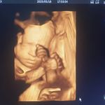 سونوگرافی رادیولوژی مرکزی اصفهان