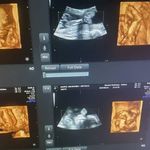 سونوگرافی رادیولوژی مرکزی اصفهان