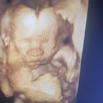 سونوگرافی رادیولوژی مرکزی اصفهان