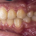 فتوگرافی پزشکی تکرنگ طب
