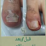 پدیکور و پودولوژیSD