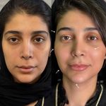 کلینیک لیزر و  زیبایی ملیح