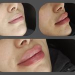 کلینیک زیبایی، لیزر و لاغری دُریتا