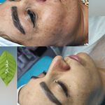 مرکز تخصصی فیشیال و مراقبت ازپوستsb,skin
