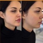 کلینیک پوست و زیبایی ژیلاوَش