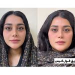 مرکز لیزر و زیبایی دکتر رسولی