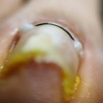 خدمات تخصصی_درمانی ناخن بهشاد داودی