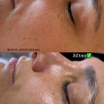 پاکسازی پوست و‌فیشال تخصصی زهراعبدالهیان