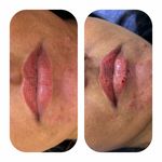 کلینیک تخصصی ژل و بوتاکس مرضیه آقابابایی
