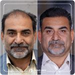 کلینیک پوست مو و زیبایی نوین ایرانا