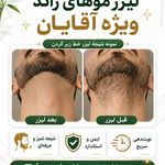 لیزر موهای زائد بامبو خرمشهر دکتر شجاع