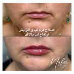 کلینیک زیبایی و لیزر مو زائد نوبا