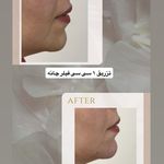 کلینیک زیبایی لاغری لیزر دانا