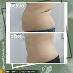 مطب تخصصی زیبایی و لاغری آنجل